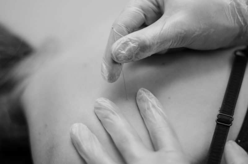 Fysiotherapie, Fysiotherapeut, Fysiotherapiepraktijk, Fysio, Beek, Kuijs Fysiotherapie, Fysiofitcare, Dry Needling